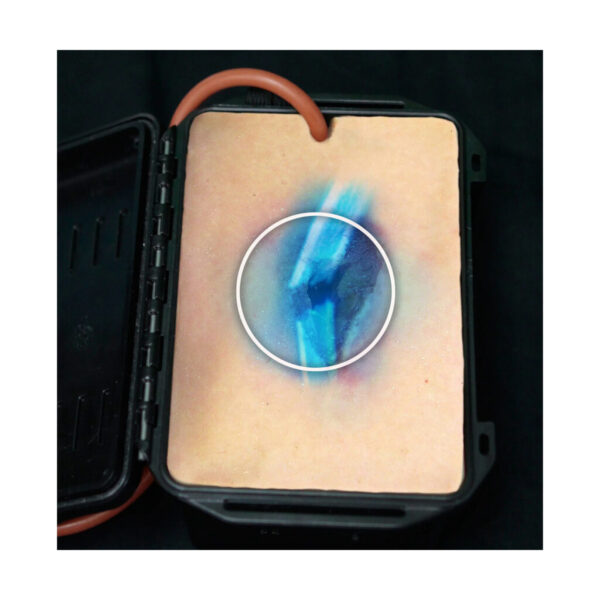 Trenazer-tamowania-krwotoku-rana-odlamkowa-Shrapnel-Wound-in-a-Box®-3.jpg